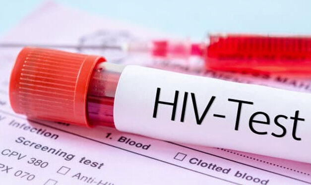 Most HIV-positive individuals in Iloilo belong to 25-34 age group