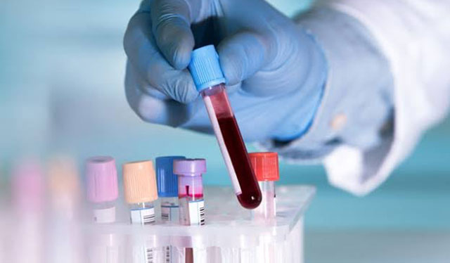 Iloilo City records new suspected COVID-19 case