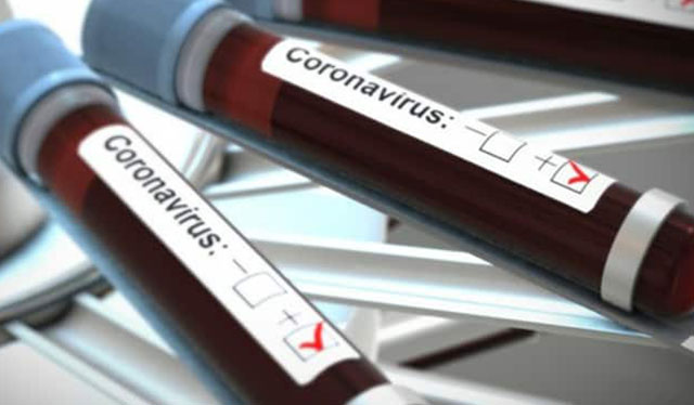 COVID-19 cases in WV rise to 4