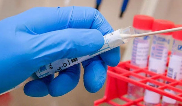 COVID-19 cases in Iloilo rise to 24