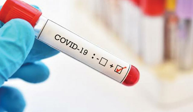 5-year-old boy from Mandurriao contracts COVID-19