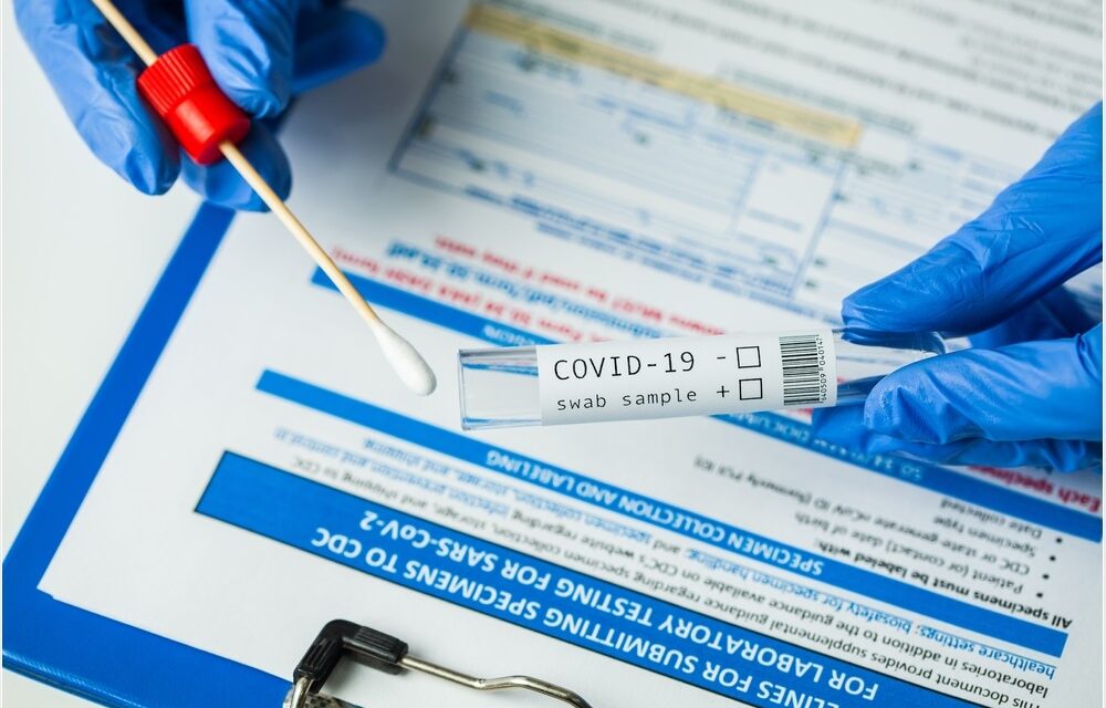 Specimens sent to PGC to know if new COVID-19 variants already present in Iloilo City