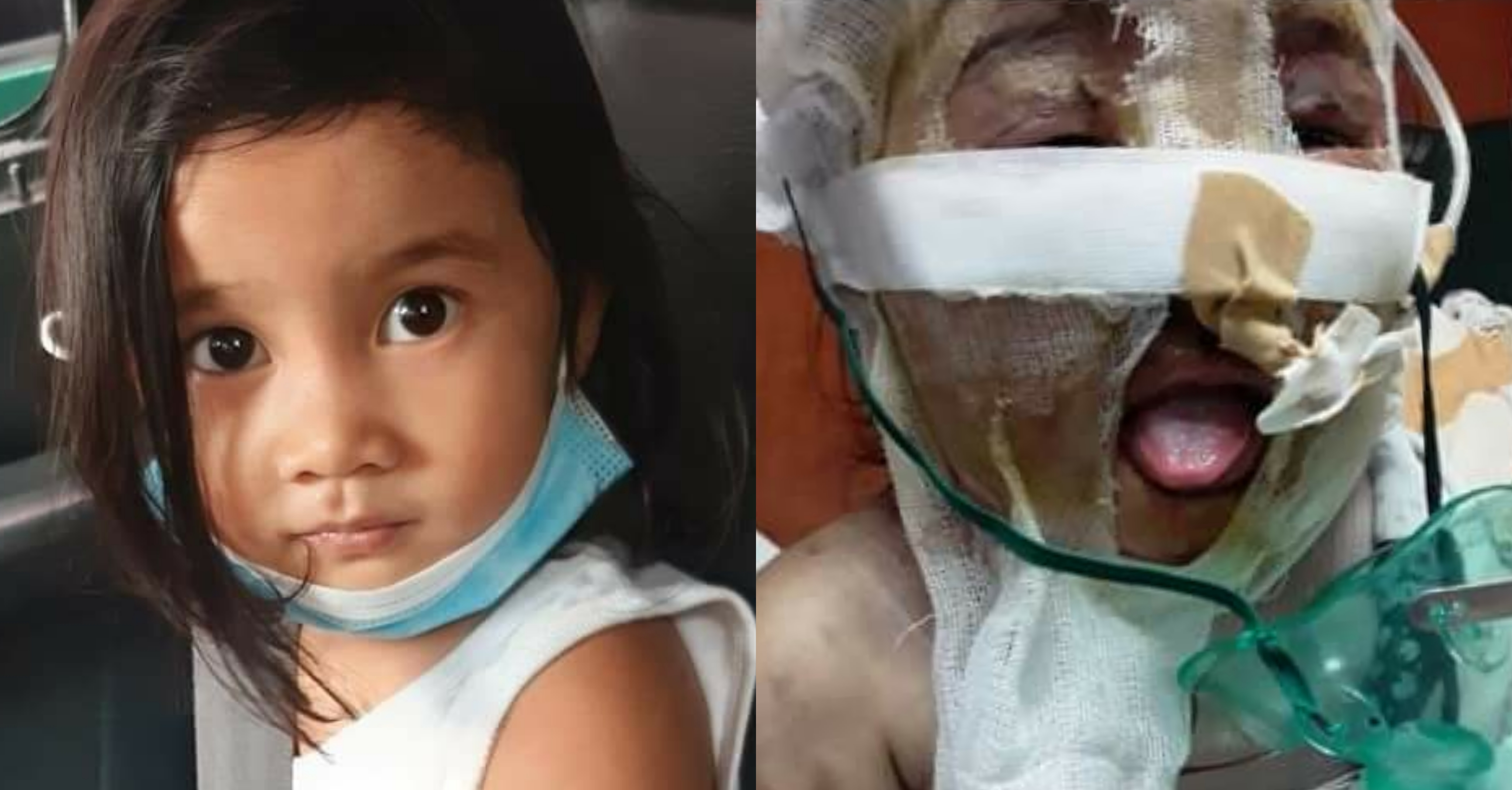 Cash donations pour in for Lambunao kid