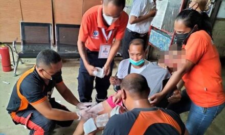 Girl suffers burns after costume caught fire