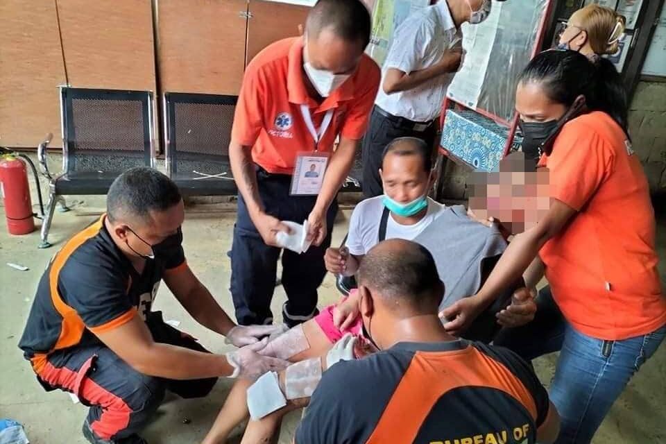 Girl suffers burns after costume caught fire