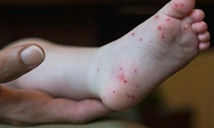 Hand-foot-and-mouth disease cases soar in Iloilo