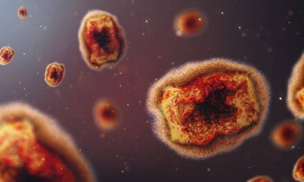 Iloilo City braces for monkeypox