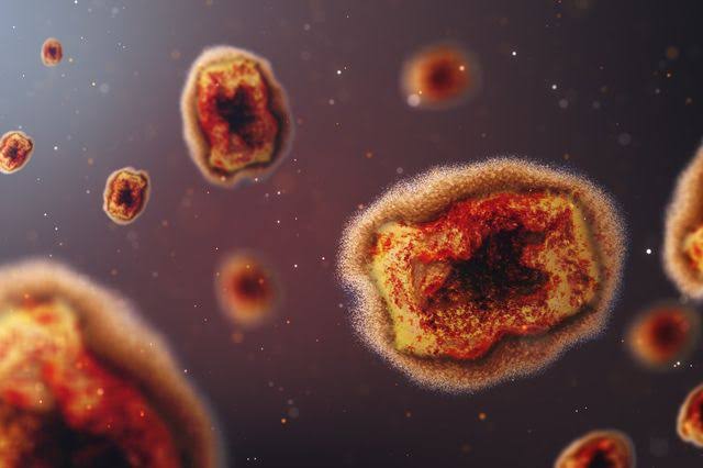 Iloilo City braces for monkeypox