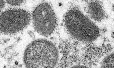 No need for lockdowns to prevent spread of monkeypox