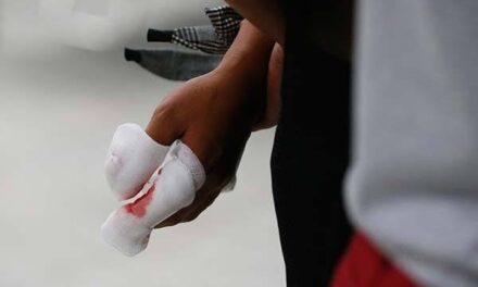 Iloilo has highest fireworks-related injuries in WV