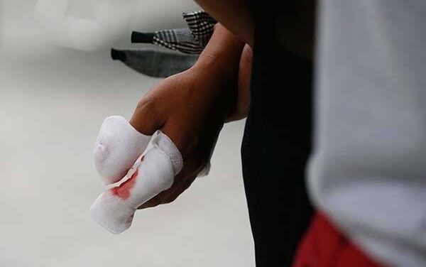 Iloilo has highest fireworks-related injuries in WV