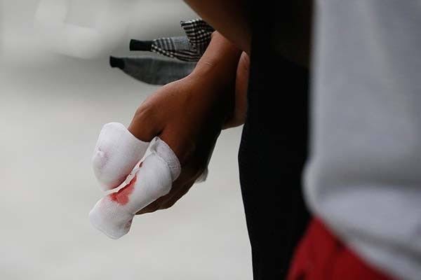 Iloilo has highest fireworks-related injuries in WV