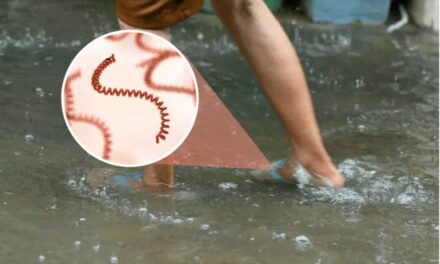 Leptospirosis kills 2 in Iloilo