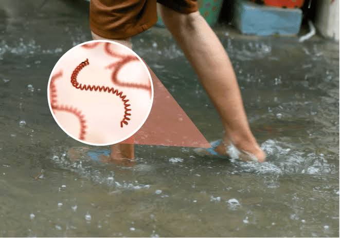 Leptospirosis kills 2 in Iloilo